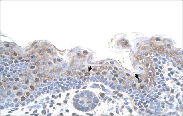 Anti-STRAP (AB2) antibody produced in rabbit