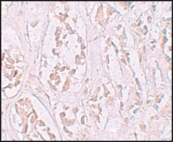 Anti-STOX2 antibody produced in rabbit