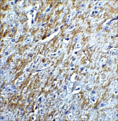 Anti-Survivin antibody produced in rabbit