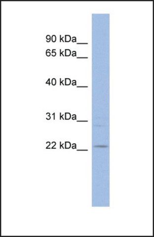 Anti-TAF10 antibody produced in rabbit