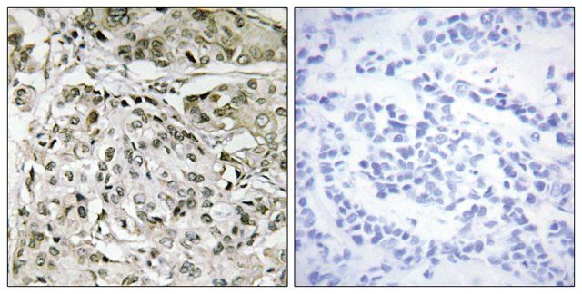 Anti-TAF1 antibody produced in rabbit