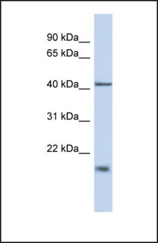 Anti-TBC1D21, (N-terminal) antibody produced in rabbit