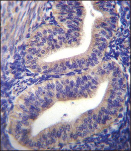 ANTI-TBPL2 (N-TERM) antibody produced in rabbit