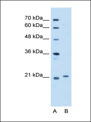 Anti-TCAP (AB2) antibody produced in rabbit