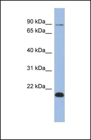 Anti-TCEB3B antibody produced in rabbit