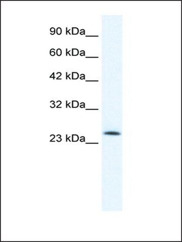 Anti-TCF7 (AB1) antibody produced in rabbit