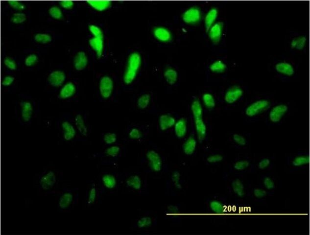 ANTI-TCF4 antibody produced in mouse