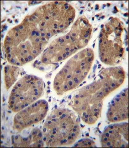 ANTI-TM181 (N-TERM) antibody produced in rabbit