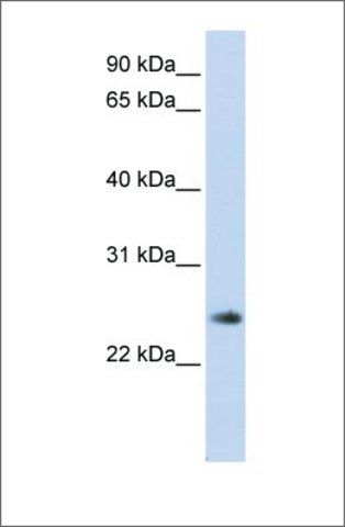 Anti-THYN1 antibody produced in rabbit