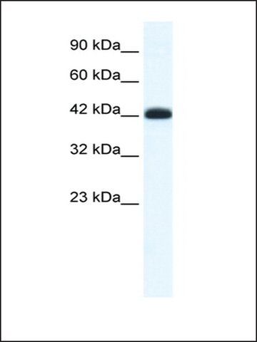 Anti-SLC2A4RG antibody produced in rabbit