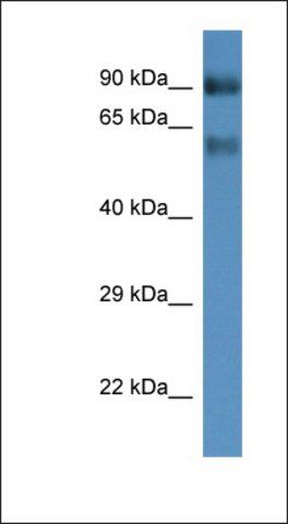 Anti-SLC6A15 antibody produced in rabbit