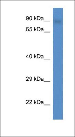 Anti-SMEK2 antibody produced in rabbit
