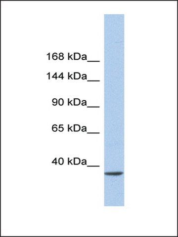 Anti-SMARCAD1 (AB2) antibody produced in rabbit