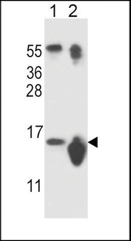 ANTI-SNRPD3 (N-TERM) antibody produced in rabbit