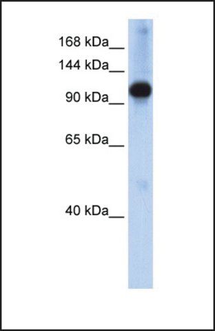 Anti-SMARCAL1, (N-terminal) antibody produced in rabbit