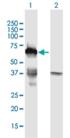 ANTI-SMAD6 antibody produced in mouse