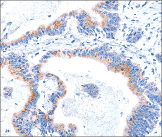 Anti-SMG8 antibody produced in rabbit