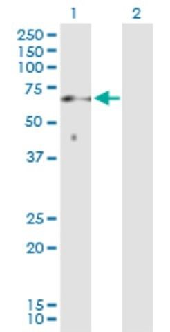 Anti-SOCS6 antibody produced in rabbit