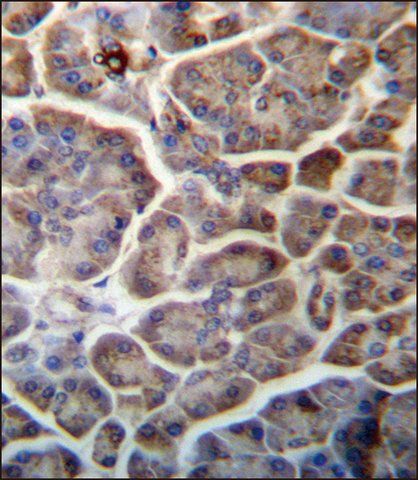 ANTI-SNX29 (C-TERM) antibody produced in rabbit