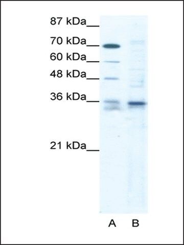 Anti-SOX12 antibody produced in rabbit