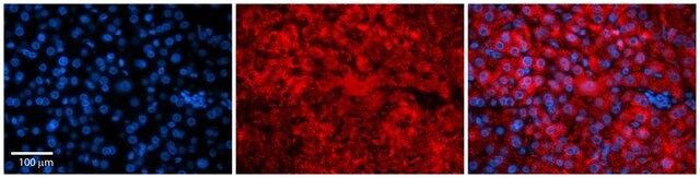 Anti-SNF8 antibody produced in rabbit