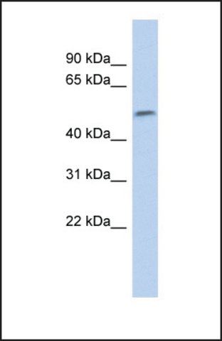 Anti-SOX11 antibody produced in rabbit