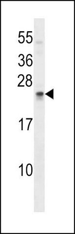 ANTI-SOSTDC1 (C-TERM) antibody produced in rabbit