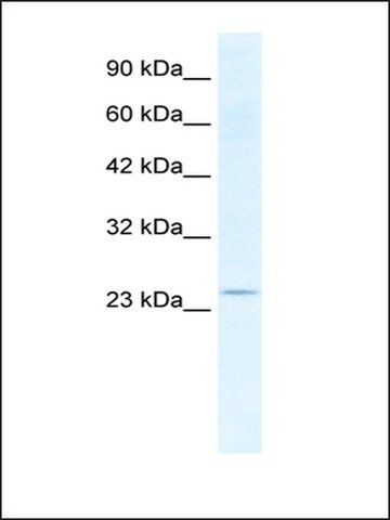 Anti-SOX14 (AB2) antibody produced in rabbit