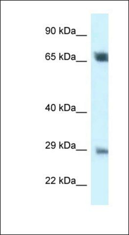 Anti-SPC25 antibody produced in rabbit