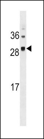 ANTI-SPC25 (CENTER) antibody produced in rabbit