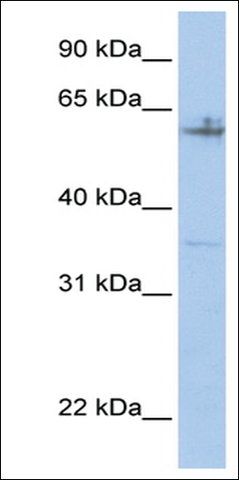 Anti-SPDEF (AB2) antibody produced in rabbit