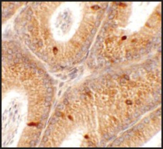 Anti-SPATA4 antibody produced in rabbit