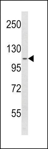 ANTI-SPINK5(N-TERMINAL) antibody produced in rabbit