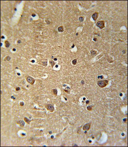 ANTI-PRG2 (CENTER) antibody produced in rabbit