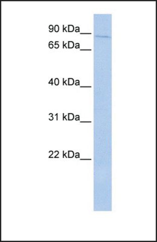 Anti-PRKRIR, (N-terminal) antibody produced in rabbit