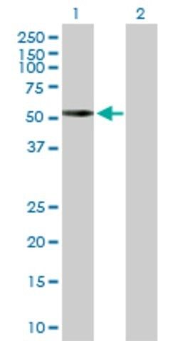 Anti-PRKACA antibody produced in rabbit
