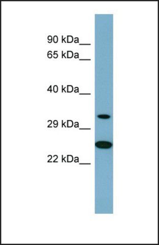 Anti-PRKAB2 antibody produced in rabbit