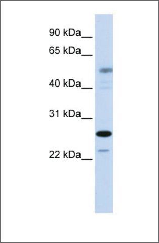 Anti-PSMC3IP antibody produced in rabbit