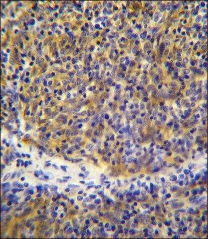 ANTI-PSMB11 (C-TERM) antibody produced in rabbit