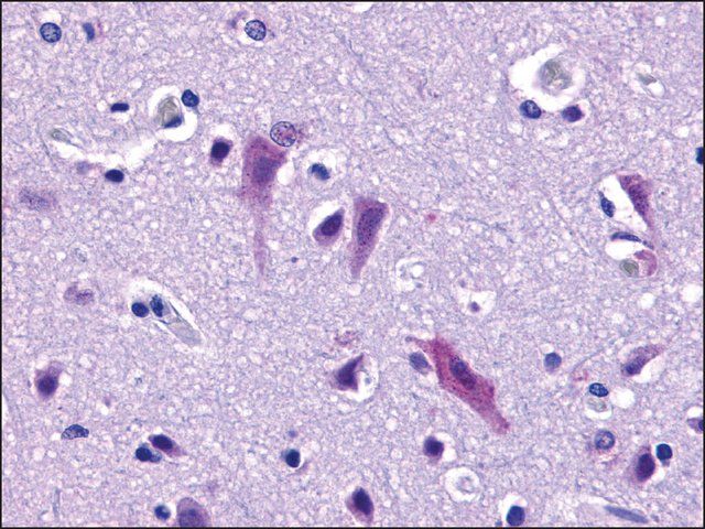 Anti-QRFPR / GPR103 antibody produced in rabbit