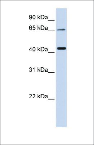 Anti-QPCTL antibody produced in rabbit