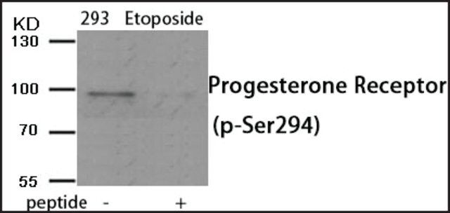 Anti-phospho-Progesterone Receptor (pSer<sup>294</sup>) antibody produced in rabbit