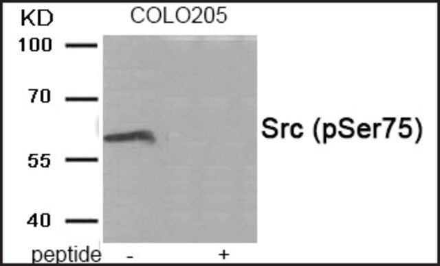 Anti-phospho-Src (pSer<sup>75</sup>) antibody produced in rabbit