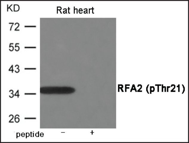 Anti-phospho-RFA2 (pThr<sup>21</sup>) antibody produced in rabbit