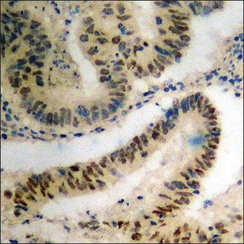 Anti-phospho-SRF (pSer<sup>99</sup>) antibody produced in rabbit