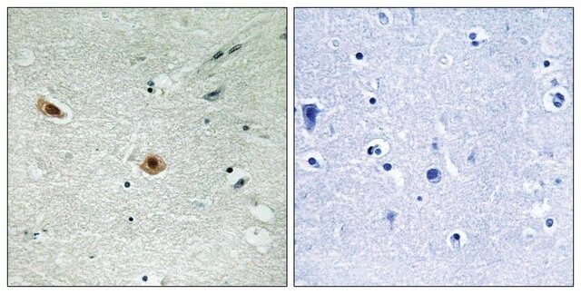 Anti-phospho-Retinoblastoma (pSer<sup>608</sup>) antibody produced in rabbit