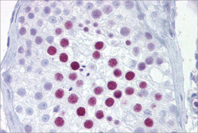 Anti-PHOX2A antibody produced in rabbit