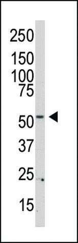 ANTI-PI 4 KINASE TYPE 2 BETA(N-TERMINAL) antibody produced in rabbit