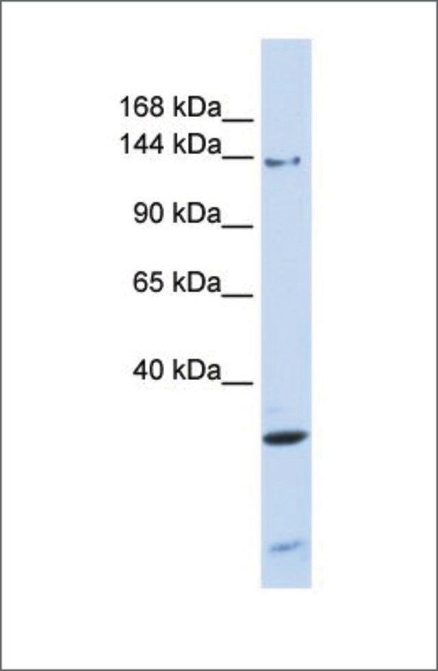 Anti-PIK3R4 antibody produced in rabbit