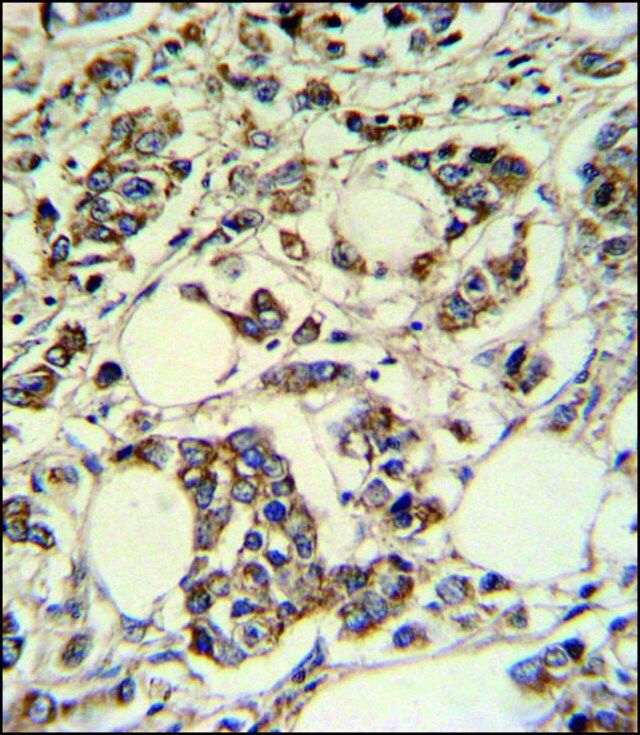 ANTI-PIGM (C-TERM) antibody produced in rabbit